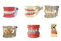 Teeth and Study Models