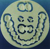 All-ceramic zirconia