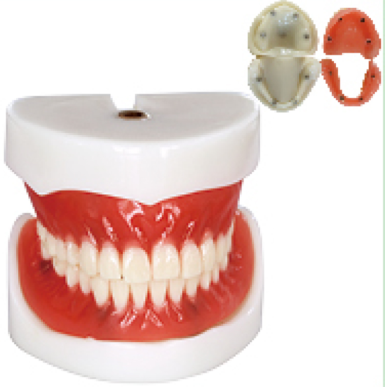 TM-T21 Full Denture Implant Mode