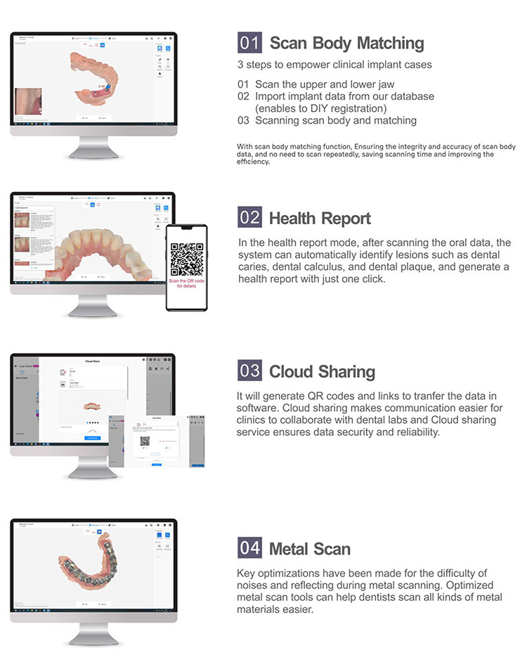 IOS33 Intraoral Scanner