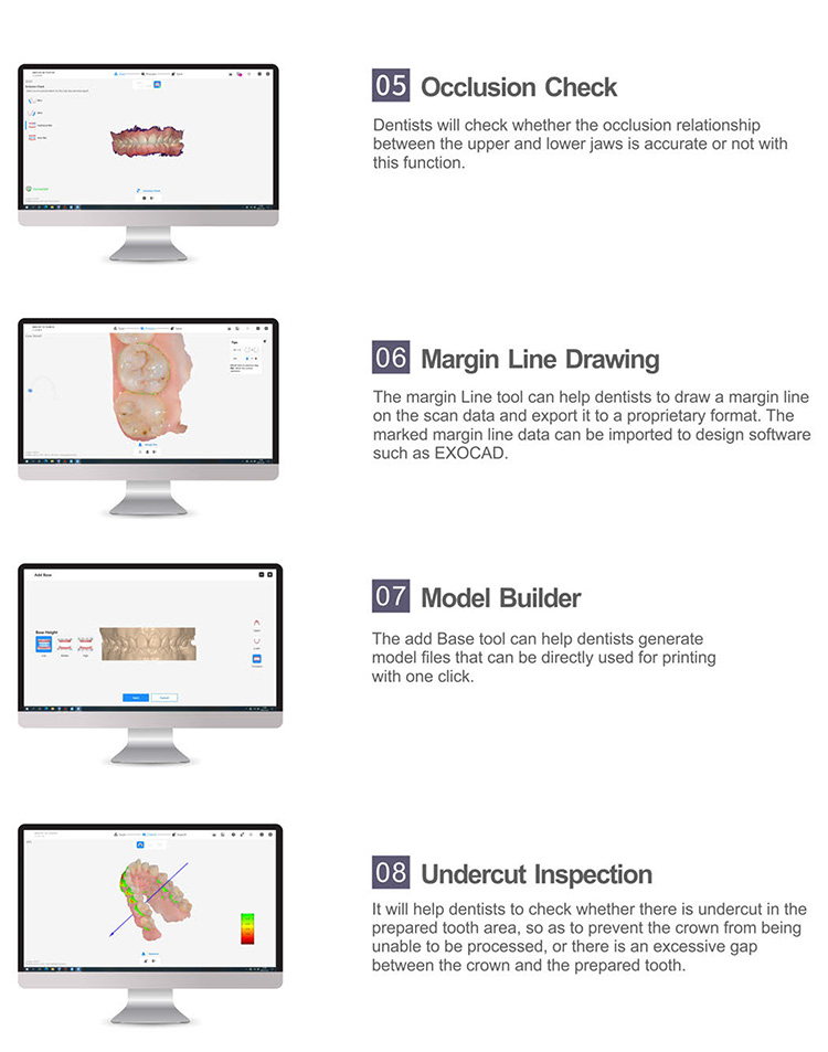 IOS33 Intraoral Scanner