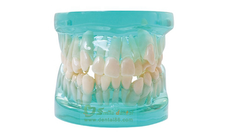 TM-B5 Orthodontic Model