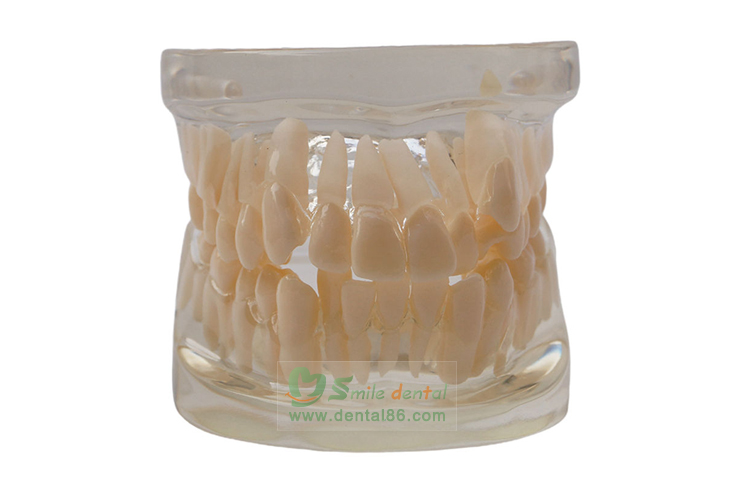 TM-B5 Orthodontic Model