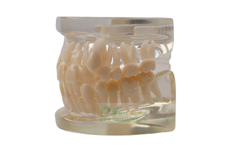 TM-B5 Orthodontic Model
