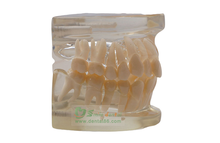 TM-B5 Orthodontic Model