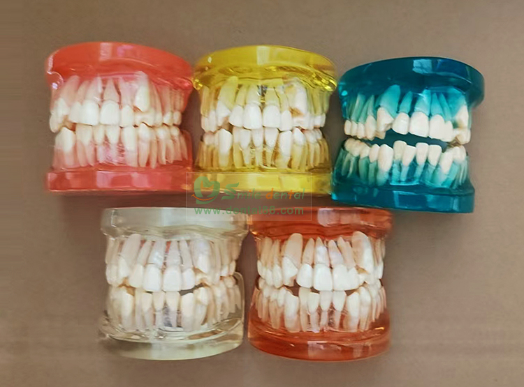 TM-B5 Orthodontic Model