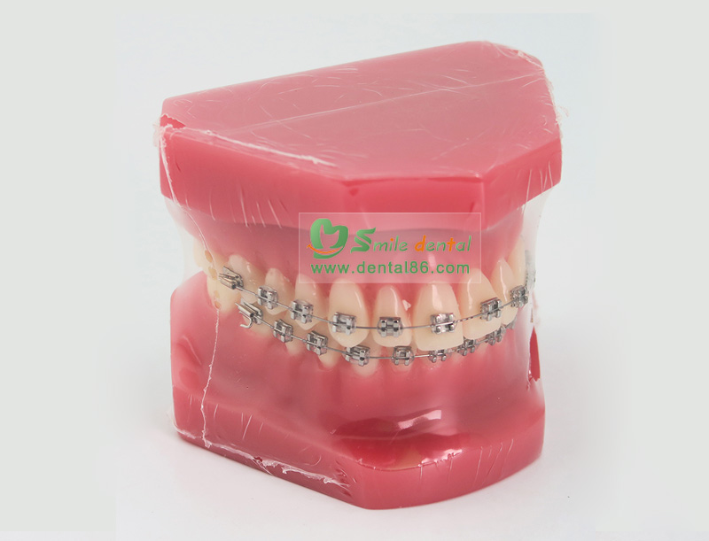Orthodontic Model